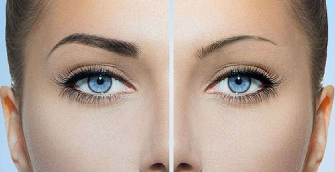 Micropigmentación facial y lunares