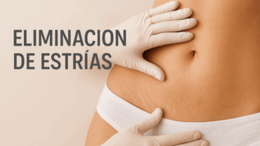 Eliminación de Estrías y Cicatrices.