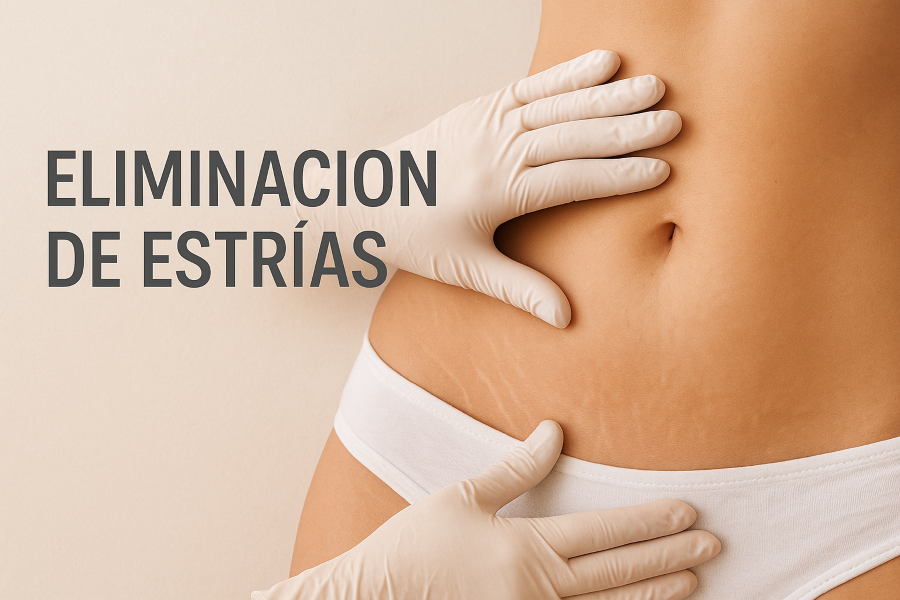 Eliminación de Estrías y Cicatrices.