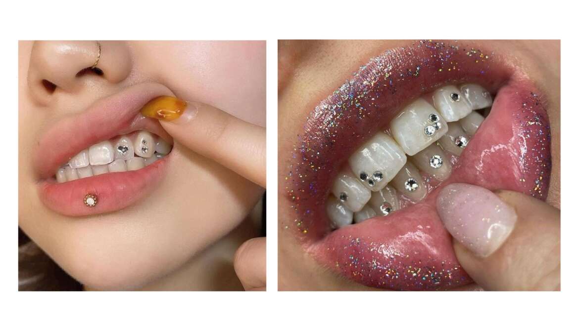 Gemas Dentales – Tooth Gems de Swarovski