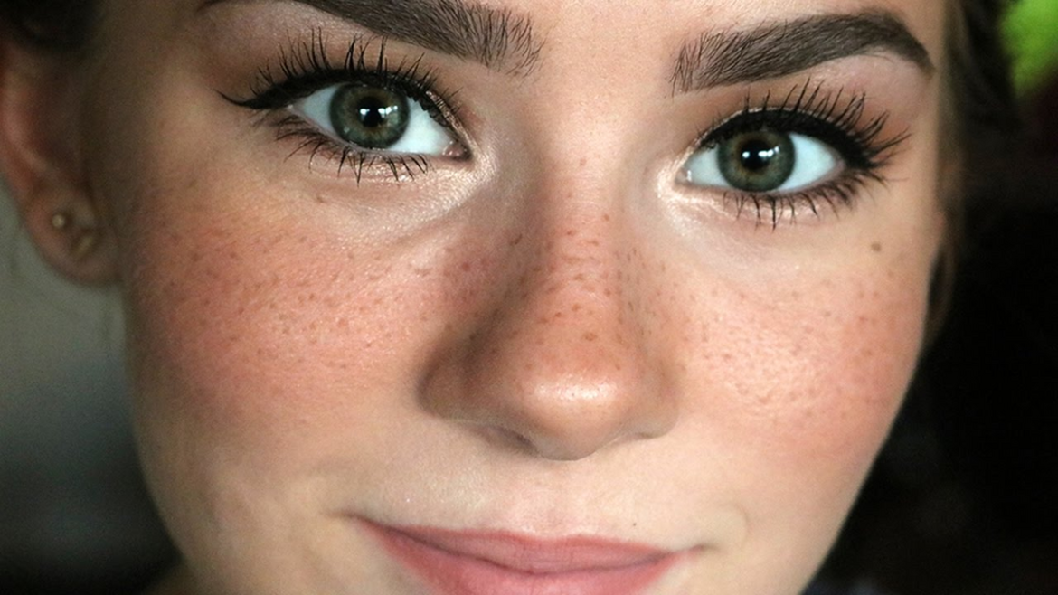 Micropigmentación pecas o Freckling, capilar y lunares