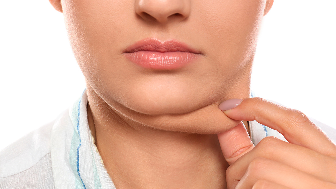 Lipo Papada con HIFU