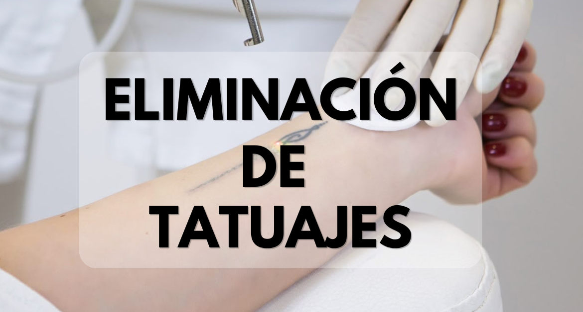 Eliminación de tatuajes con láser: tecnología avanzada para borrar el pasado y recuperar tu piel