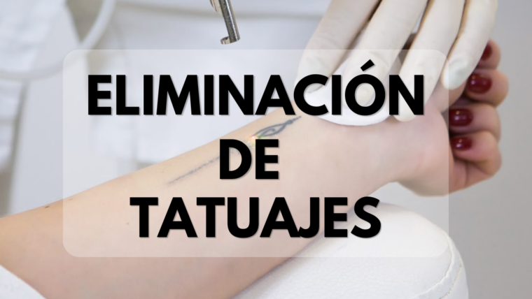Eliminación de tatuajes con láser: tecnología avanzada para borrar el pasado y recuperar tu piel