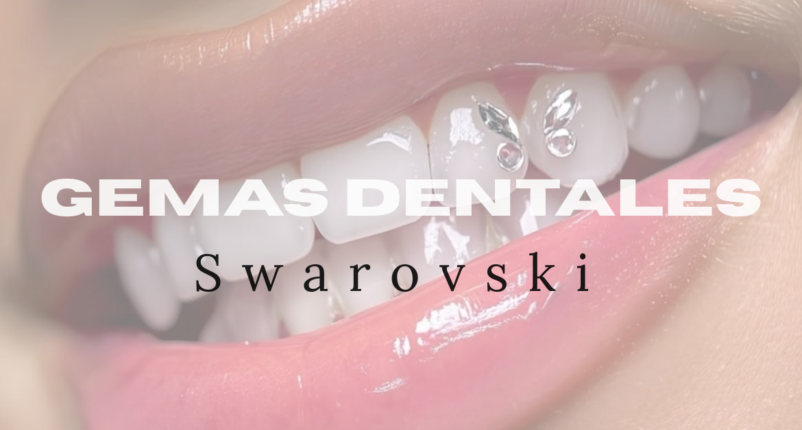 Gemas dentales Swarovski: un detalle brillante para tu sonrisa